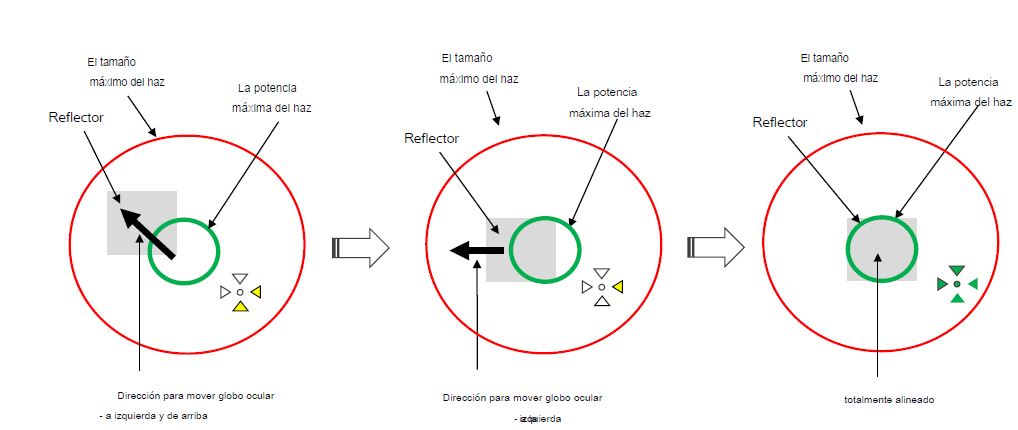 Pasos de alineación